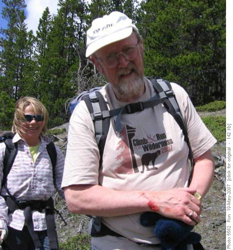 {165 Ton For} showing off wrist wound